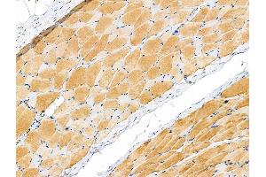 Phospho-PYGL (Ser15) Antibody at 1/100 staining Rat ovarian tissue by IHC-P. (PYGL anticorps  (pSer15))