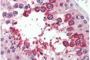 Testis, Human: Formalin-Fixed, Paraffin-Embedded (FFPE)