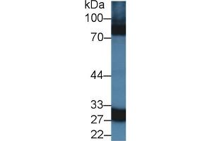Western Blot; Sample: Rat Spleen lysate; Primary Ab: 1. (CA5A anticorps  (AA 12-219))