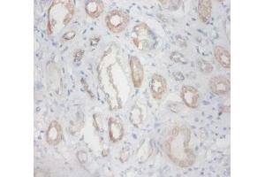 Immunohistochemistry of paraffin-embedded human kidney tissue using ABIN7176559 at dilution of 1:100 (ZFP91 anticorps  (AA 1-208))