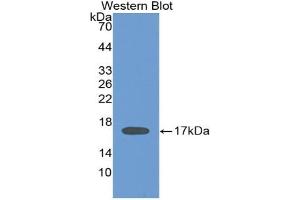 Detection of Recombinant IL2, Human using Monoclonal Antibody to Interleukin 2 (IL2) (IL-2 anticorps  (AA 21-153))