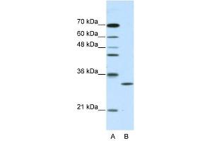 CLIC1 antibody used at 2. (CLIC1 anticorps  (C-Term))