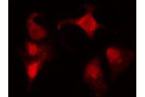 anti-Zinc Finger Protein 682 (ZNF682) (N-Term) antibody