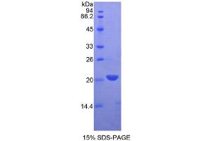 SDS-PAGE analysis of Rat LECT2 Protein.