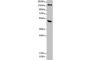 Western blot All lanes: MTUS1 antibody at 3. (MTUS1 anticorps  (AA 1041-1270))