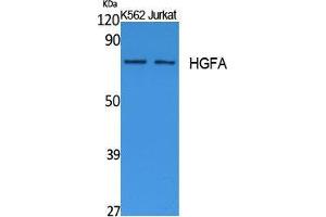 Western Blotting (WB) image for anti-Hepatocyte Growth Factor Activator (HGFA) (C-Term) antibody (ABIN3178102) (HGFA anticorps  (C-Term))