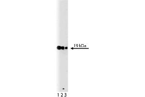 Western blot analysis of p19 [Skp1] on a A431 lysate. (SKP1 anticorps  (AA 4-158))