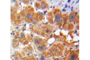 Used in DAB staining on fromalin fixed paraffin-embedded Liver tissue (Apolipoprotein F anticorps  (AA 111-314))