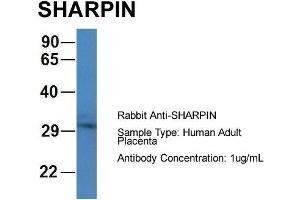 Host: Rabbit Target Name: CHAD Sample Type: Human Adult Placenta Antibody Dilution: 1. (SHARPIN anticorps  (C-Term))