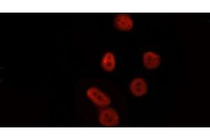 ABIN6277777 staining HepG2 by IF/ICC. (LEF1 anticorps  (Internal Region))