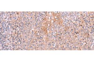 Immunohistochemistry of paraffin-embedded Human tonsil tissue using ZSWIM1 Polyclonal Antibody at dilution of 1:55(x200) (ZSWIM1 anticorps)