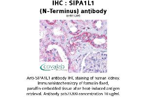 Image no. 1 for anti-Signal-Induced Proliferation-Associated 1 Like 1 (SIPA1L1) (N-Term) antibody (ABIN1739266) (SIPA1L1 anticorps  (N-Term))