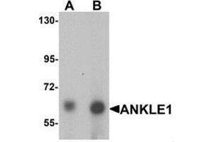 Western blot analysis of ANKLE1 in 293 cell lysate with ANKLE1 antibody at (A) 1 and (B) 2 ug/mL. (ANKLE1 anticorps  (C-Term))