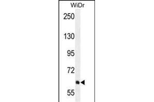PIK3R5 Antibody (C-term) (ABIN655491 and ABIN2845011) western blot analysis in WiDr cell line lysates (35 μg/lane). (PIK3R5 anticorps  (C-Term))
