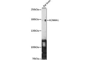 Western blot analysis of extracts of Rat brain, using KCNM antibody (5283) at 1:1000 dilution.