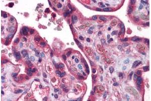 Human Placenta: Formalin-Fixed, Paraffin-Embedded (FFPE)