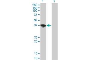 Western Blot analysis of SORD expression in transfected 293T cell line by SORD monoclonal antibody (M01), clone 4D3.