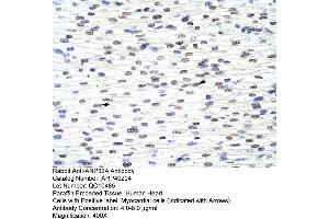 Rabbit Anti-ANP32A Antibody  Paraffin Embedded Tissue: Human Heart Cellular Data: Myocardial cells Antibody Concentration: 4.