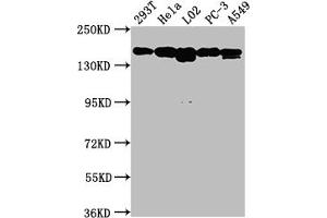 Western Blot Positive WB detected in: 293T whole cell lysate, Hela whole cell lysate, L02 whole cell lysate, PC-3 whole cell lysate, A549 whole cell lysate All lanes: MET antibody at 1:1500 Secondary Goat polyclonal to rabbit IgG at 1/50000 dilution Predicted band size: 156, 158, 86 kDa Observed band size: 156 kDa (Recombinant c-MET anticorps)