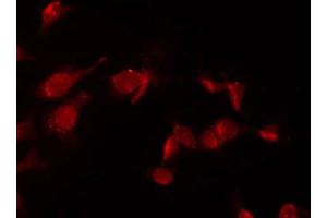 ABIN6272325 staining Hela by IF/ICC.