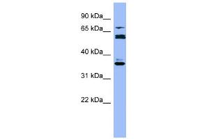 WB Suggested Anti-CYP2B6 Antibody Titration:  0. (CYP2B6 anticorps  (Middle Region))