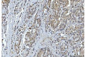 IHC analysis of YWHAE using anti-YWHAE antibody (ABIN7599165). (YWHAE anticorps  (AA 1-255))