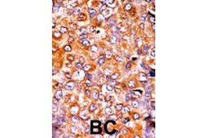 Immunohistochemistry (IHC) image for anti-Myelin Transcription Factor 1 (MYT1) (pThr495) antibody (ABIN3001766) (MYT1 anticorps  (pThr495))