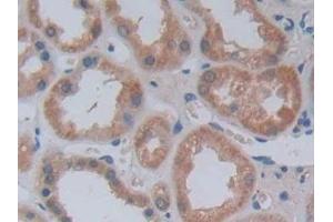 Detection of JAG2 in Human Kidney Tissue using Polyclonal Antibody to Jagged 2 Protein (JAG2)