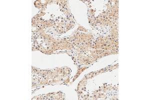 Immunohistochemical analysis of paraffin-embedded Human testis tissue using B performed on the Leica® BOND RXm. (AMHR2 anticorps  (N-Term))