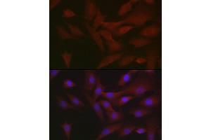 Immunofluorescence analysis of NIH/3T3 cells using RIPK3 Rabbit pAb (ABIN6132598, ABIN6146964, ABIN6146967 and ABIN6221084) at dilution of 1:50 (40x lens).
