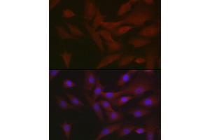 Immunofluorescence analysis of NIH/3T3 cells using RIPK3 Rabbit pAb (ABIN6132598, ABIN6146964, ABIN6146967 and ABIN6221084) at dilution of 1:50 (40x lens). (RIPK3 anticorps  (AA 1-120))