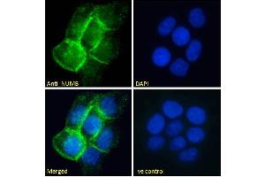 ABIN184679 Immunofluorescence analysis of paraformaldehyde fixed A431 cells, permeabilized with 0. (NUMB anticorps  (C-Term))