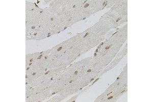 Immunohistochemistry of paraffin-embedded mouse heart using SFRS9 antibody. (SFRS9 anticorps)