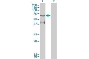 Western Blot analysis of ETV4 expression in transfected 293T cell line by ETV4 monoclonal antibody (M01), clone 3G9-1B9.