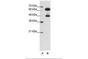 Image no. 1 for anti-Small Nuclear Ribonucleoprotein 70kDa (U1) (SNRNP70) (AA 301-350) antibody (ABIN6736194) (SNRNP70 anticorps  (AA 301-350))