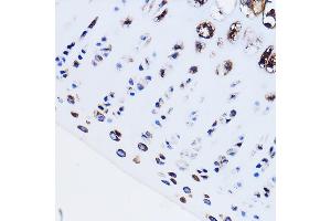 Immunohistochemistry of paraffin-embedded Rat leg bone using PTH1R Rabbit pAb (ABIN3022477, ABIN3022478, ABIN3022479, ABIN1513445 and ABIN6218844) at dilution of 1:100 (40x lens).