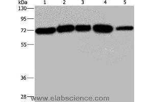 Western blot analysis of A172, Hela and 293T cell, K562 cell and human testis tissue, using AGFG1 Polyclonal Antibody at dilution of 1:533 (AGFG1 anticorps)