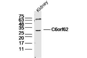 Mouse kidney lysates probed with C6orf62 Polyclonal Antibody, Unconjugated  at 1:300 dilution and 4˚C overnight incubation.