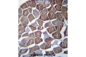 NPHP3 Antibody (N-term) immunohistochemistry analysis in formalin fixed and paraffin embedded human skeletal muscle followed by peroxidase conjugation of the secondary antibody and DAB staining. (NPHP3 anticorps  (N-Term))