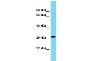 Host: Rabbit Target Name: METRNL Sample Type: Fetal Liver lysates Antibody Dilution: 1. (METRNL anticorps  (C-Term))