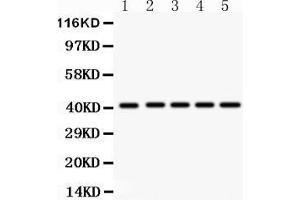 Anti- HOXA10 antibody, Western blotting All lanes: Anti HOXA10  at 0. (HOXA10 anticorps  (AA 57-340))