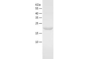 Western Blotting (WB) image for CTD Small Phosphatase-Like Protein (CTDSPL) (AA 82-265) protein (His-IF2DI Tag) (ABIN7122509)