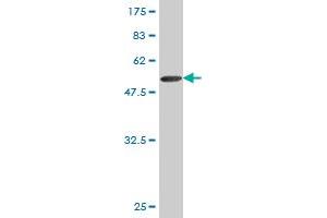 Western Blot detection against Immunogen (51. (TK1 anticorps  (AA 1-234))