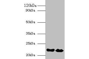 Western blot All lanes: IFNA21 antibody at 2 μg/mL Lane 1: NIH/3T3 whole cell lysate Lane 2: HepG2 whole cell lysate Secondary Goat polyclonal to rabbit IgG at 1/10000 dilution Predicted band size: 22 kDa Observed band size: 22 kDa (IFNA21 anticorps  (AA 24-189))