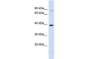Host:  Rabbit  Target Name:  RHBDL2  Sample Type:  293T Whole Cell lysates  Antibody Dilution:  1. (RHBDL2 anticorps  (N-Term))