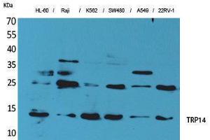 Western Blotting (WB) image for anti-Thioredoxin Domain Containing 17 (TXNDC17) (Tyr796) antibody (ABIN3178162) (TXNDC17 anticorps  (Tyr796))