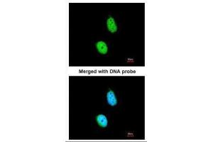 ICC/IF Image Immunofluorescence analysis of paraformaldehyde-fixed HeLa, using ERCC8, antibody at 1:200 dilution.