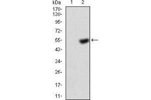 Western blot analysis using KBTBD8 mAb =against HEK293 (1) and KBTBD8 (AA: 264-464)-hIgGFc transfected HEK293 (2) cell lysate. (KBTBD8 anticorps  (AA 264-464))