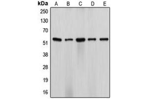 Western blot analysis of Cytochrome P450 17A1 expression in HeLa (A), NIH3T3 (B), H9C2 (C), SW13 (D), ES2 (E) whole cell lysates. (CYP17A1 anticorps  (Center))