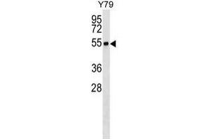 RNF26 Antibody (Center) (ABIN1538178 and ABIN2849785) western blot analysis in Y79 cell line lysates (35 μg/lane). (RNF26 anticorps  (AA 247-273))